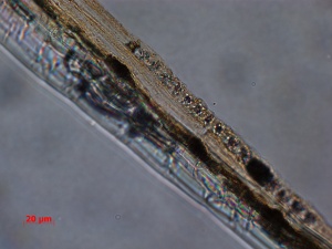 Sn-037-06-22-09-BF-400X-MM-4-9-fibers and crystals.jpg