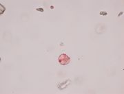 PLM starch particle with lake PPL 400x.jpg