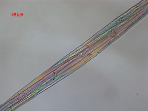CM-041-11-13-09-BF-200X-MM-3-9-overall fibers.jpg