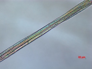 CM-039-11-13-09-BF-200X-MM-1-9-overall fibers.jpg