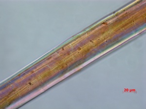 WN-037-10-29-09-BF-400X-PM-4-9-overall fibers.jpg
