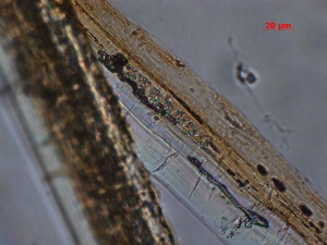 SN-035-06-22-09-BF-400X-MM-4-9-overall fibers and crystals.jpg